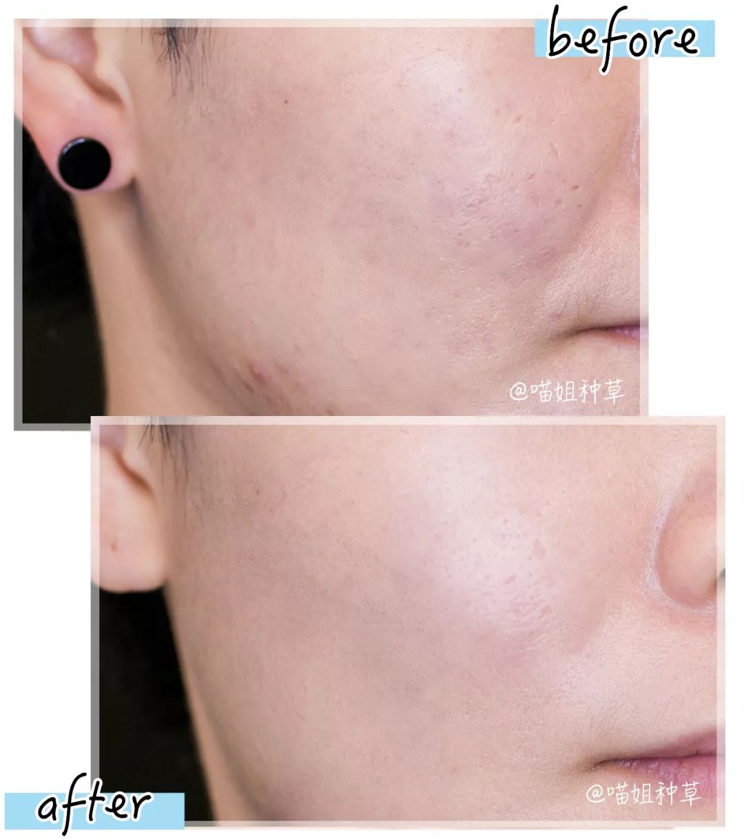 皮肤科医生护肤简单,皮肤科医生各种药膏的护肤作用