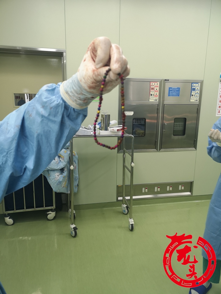 6岁男孩误食巴克球,11岁误食三颗巴克球怎么办