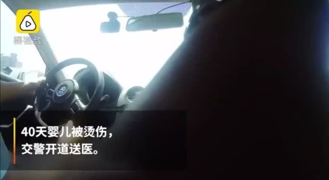 心疼！菏泽一月嫂抱仅40天男婴做饭时锅中鸡蛋突然爆开，孩子腿和肚皮烫出了泡...