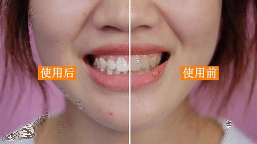 牙龈上火牙周护理牙膏,牙龈上火牙膏