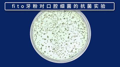 俄罗斯牙膏去黄牙怎么样,祛牙垢黄牙的牙膏国货之光