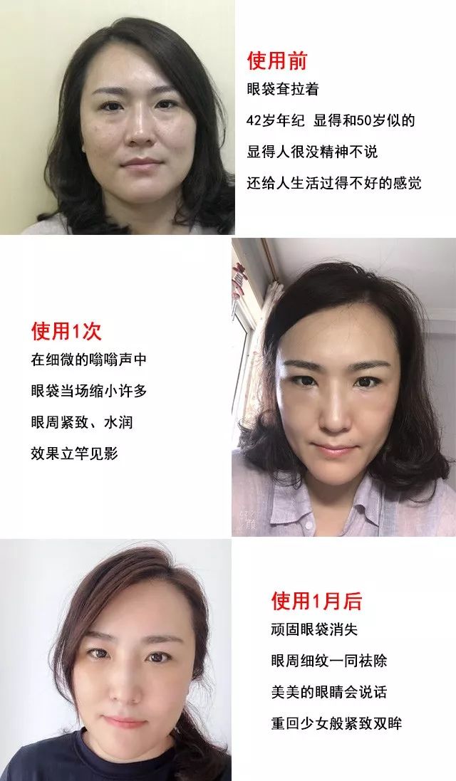 解决眼袋只需3步,不管眼袋多严重用点它