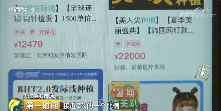 头顶脱发植发有用吗,中国脱发人数2024