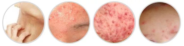 除螨杀菌喷雾好物推荐,家用除螨喷雾好物推荐