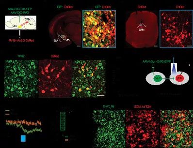 抑郁症研究获突破,中国科大攻关取得重要进展