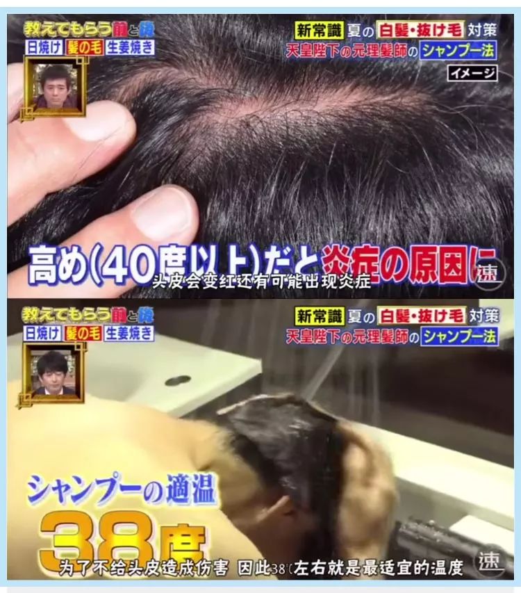 头发多久洗一次最好大多数都错了,头发多久洗一次比较合理