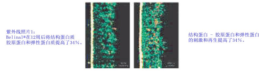 深度|欧洲白杉对皮肤健康及促进胶原蛋白的作用