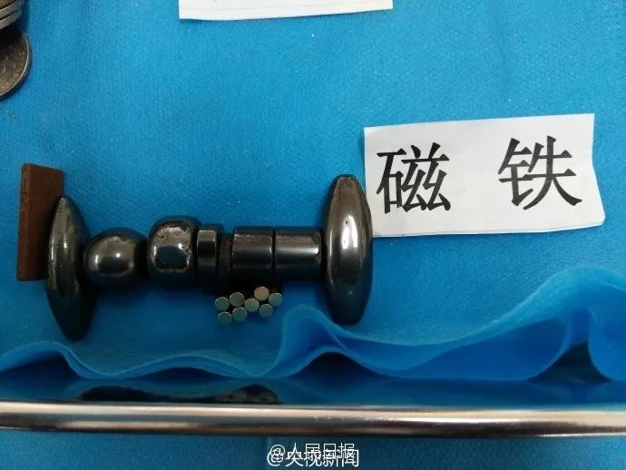 3岁女童患怪病肚子大如球,7岁女童突然腹痛元凶竟是畸胎瘤