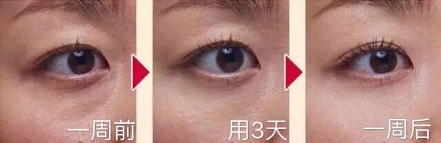 好用的神仙面膜推荐一下,日本十大贵妇面膜