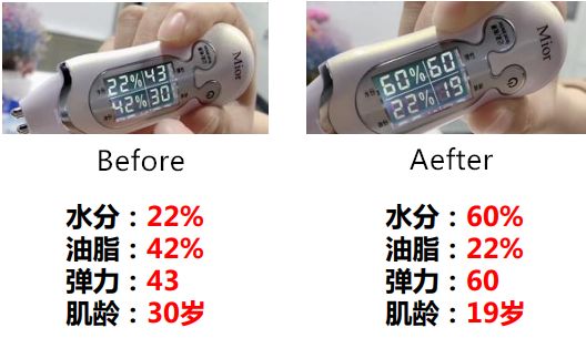 神奇的修护面霜,7ml高效急救面霜