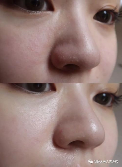 超便宜补水保湿精华,超好用的补水精华