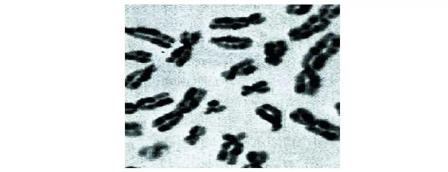 面部蝶形红斑一定是红斑狼疮吗,面颈部环状红斑是什么原因引起的