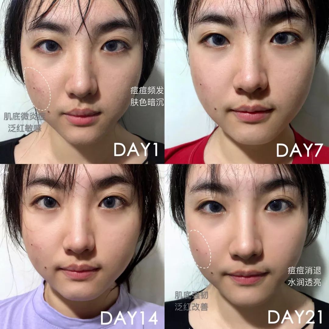 肌诊室·特别版|真人体验，医美素颜光vs明星微精华，改善皮肤哪家强？