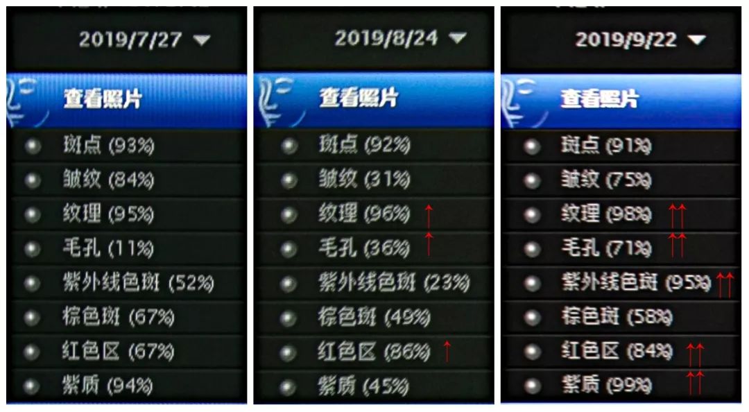 肌诊室修复,肌诊室水光肌挑战