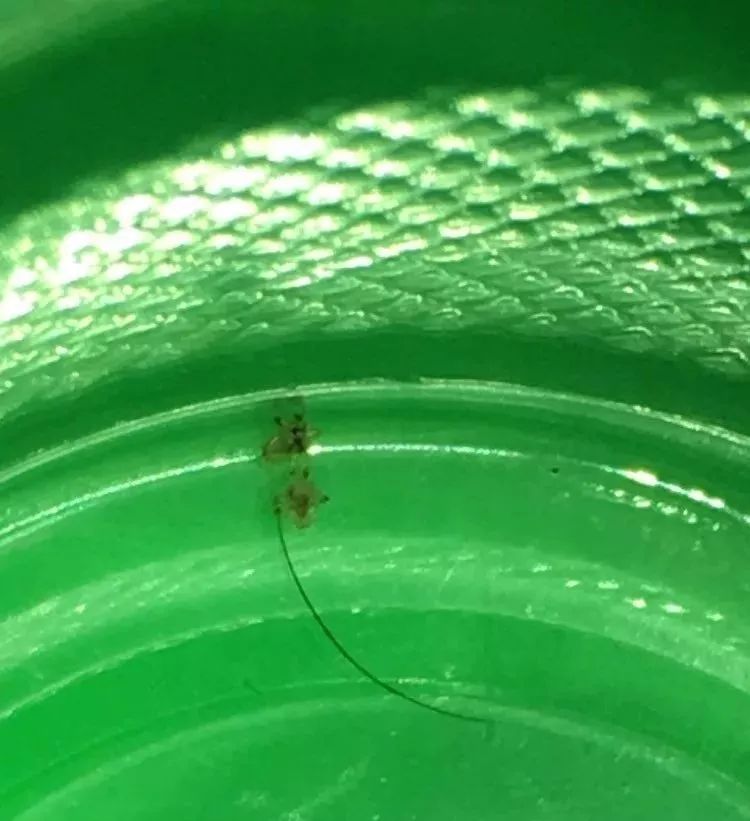 5岁女孩眼睛有虱子,宝宝一直揉眼睛是长虱子吗