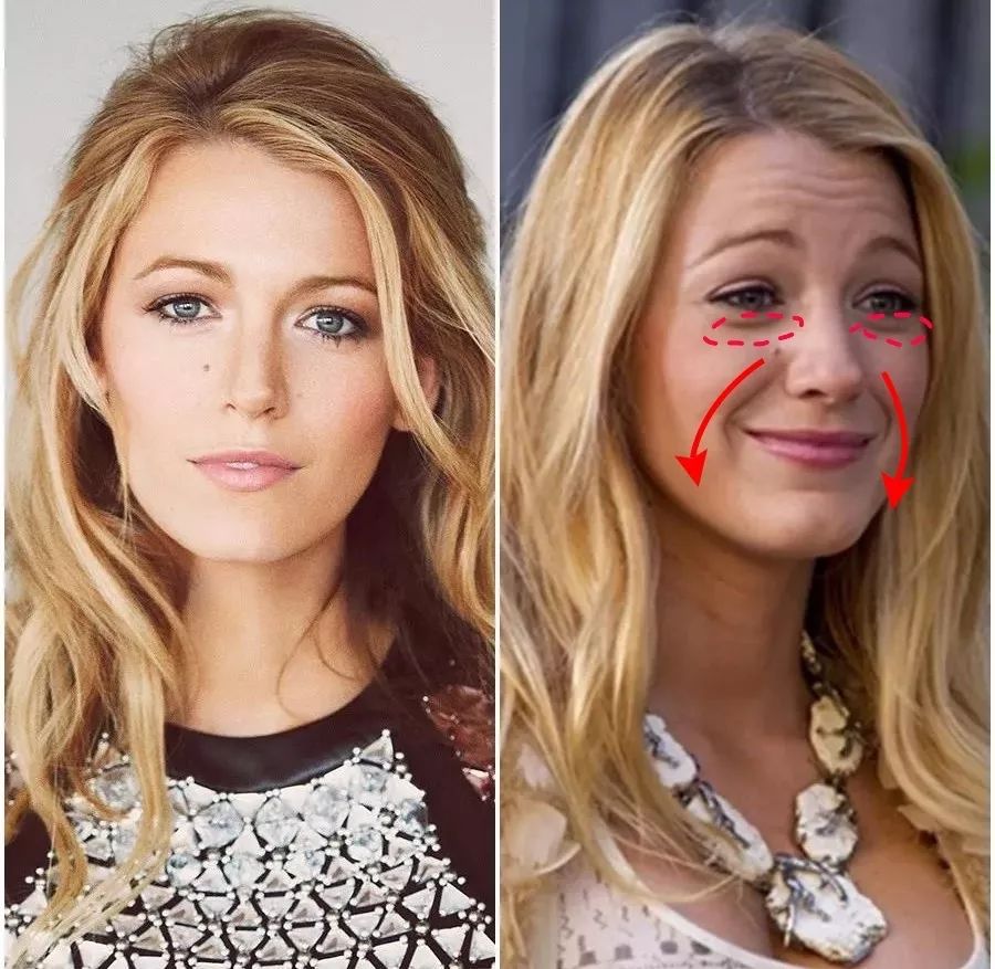 法令纹和眼纹怎么才能有效改善,法令纹贴眼贴有用吗