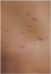 好书推荐｜《皮肤病彩*图色**谱》（第4版）