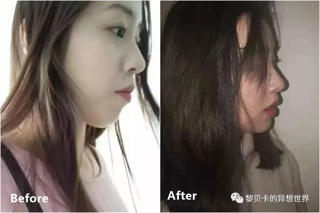 最短只要一年，这件事做对了堪比整容