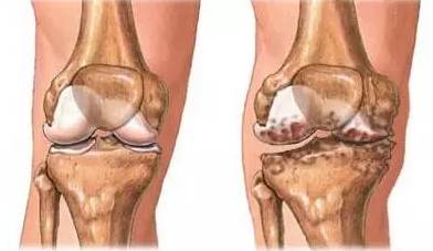 40岁后身上长了很多刺,50岁了身上长刺怎么办