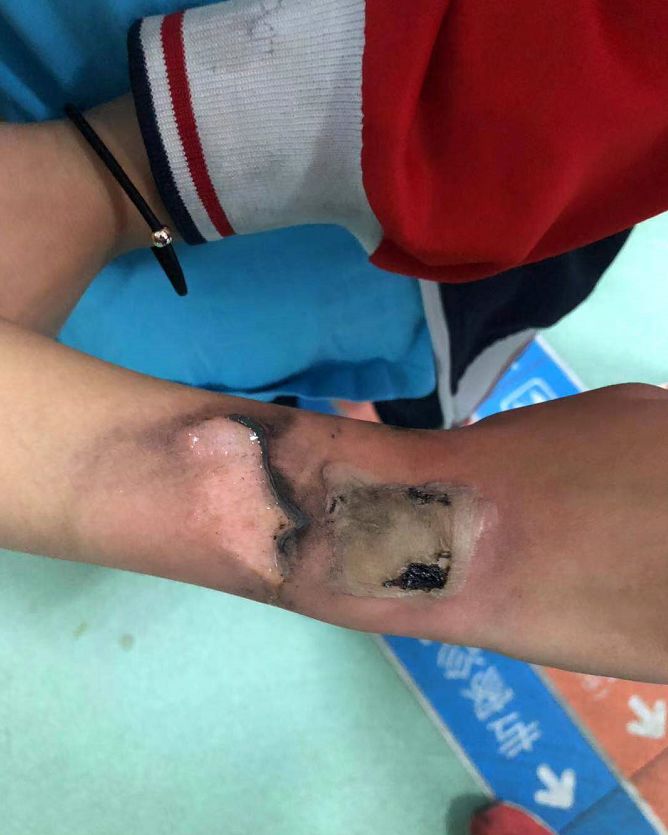 紧急提醒你家孩子天天用的东西,紧急提醒孩子天天戴什么