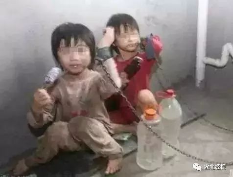 眼球被挖的人后续,眼球被挖了之后眼皮还能睁开吗