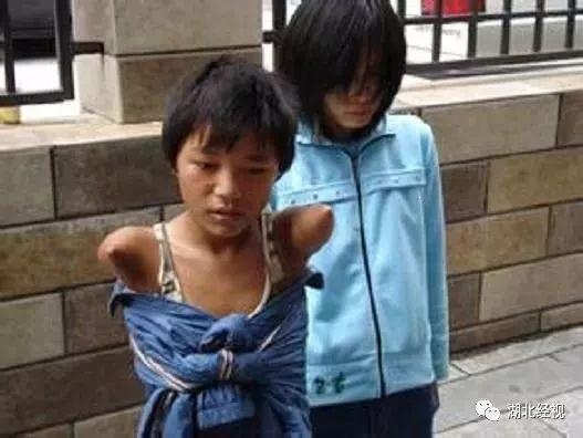 眼球被挖被拐孩子究竟经历了什么,眼球被挖走了还能恢复吗