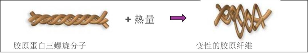 热玛吉抗衰老手术适应6类人群,了解热玛吉抗衰老看这篇就够了