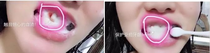 牙龈上火、红肿，还口臭？香港人用了91年的中药牙膏，消炎抑菌，让你刷出一口健康好牙