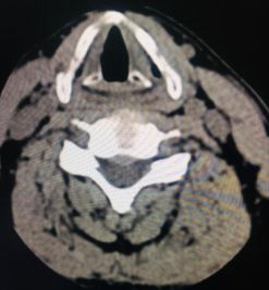 蒙自第一人民医院中医科,蒙自市中医院专家门诊