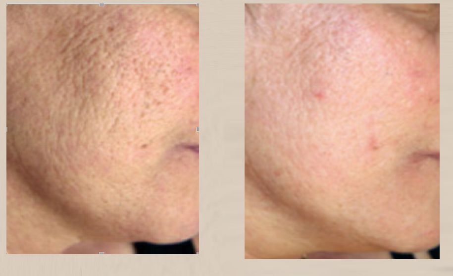 蒙自第一人民医院中医科,蒙自市中医院专家门诊