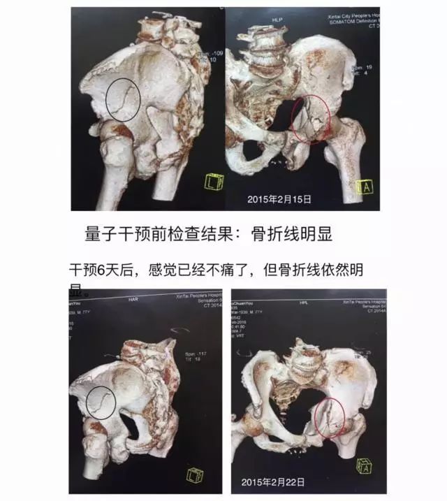 物理不好学了物理专业会怎么样,物理专业真的没出路吗