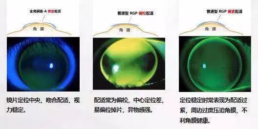 近视防控的最有效的三大方法,近视防控的常用方法与最新进展