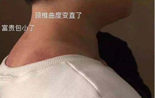 一招改善肩部疼痛,4个方法缓解肩周疼痛