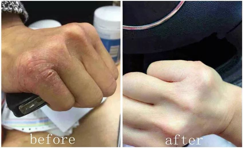 手部护理保养精油,spa护理手套