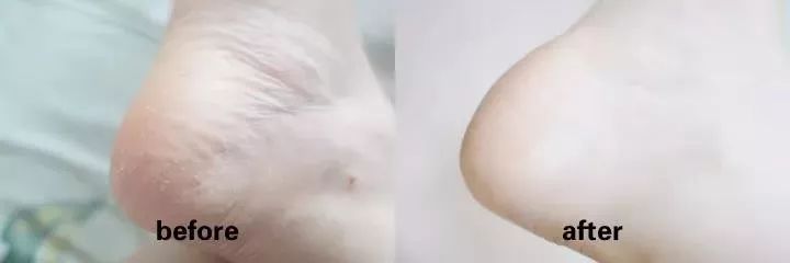 spa绮炬补缇庡鎵嬪,绮炬补spa鎵嬮儴