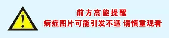 牛结节性皮肤病防控干货,一起来认识全身经络