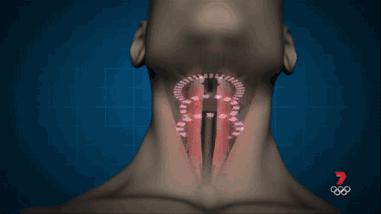 呼噜喷雾小孩能用吗,零到一岁的宝宝呼噜止鼾神器