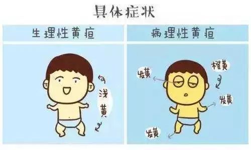 新生婴儿黄疸的图片,新生婴儿黄疸270