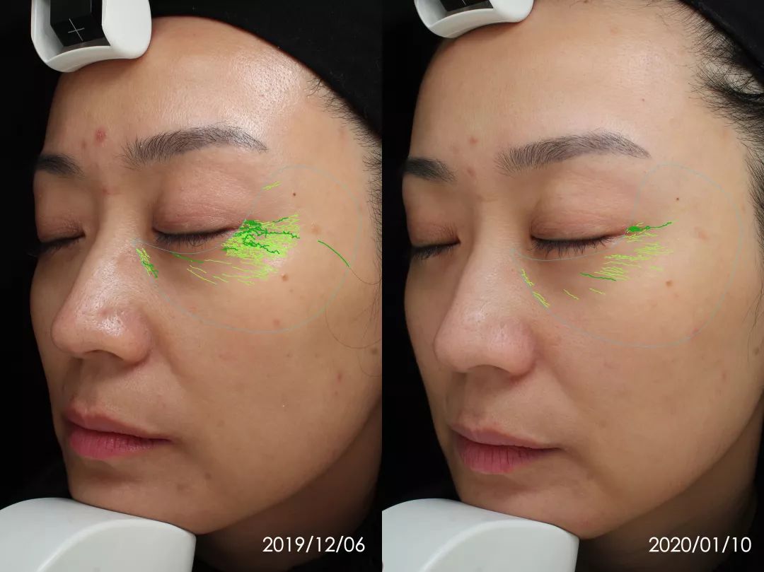 抗老三部曲紧致少女肌,抗老做好这五步hold住童颜少女肌