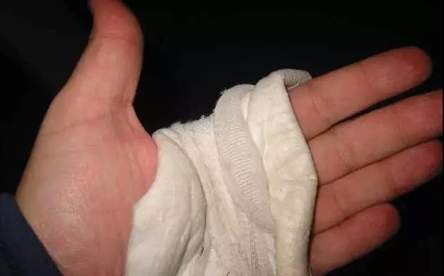 穿着衣服被开水烫伤急救,开水烫伤的急救措施