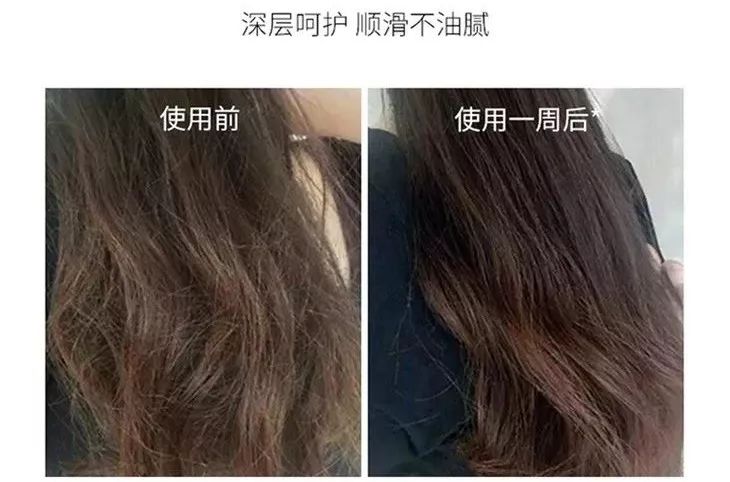 头上又油又有头皮屑又痒怎么办,头上又痒又油有头屑