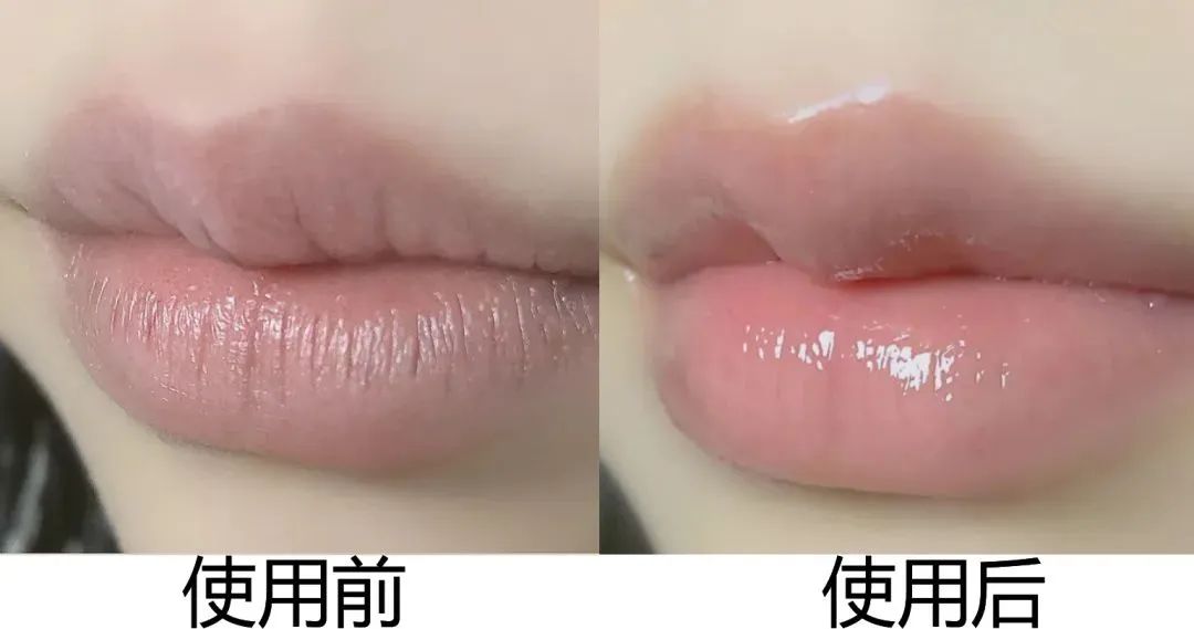 嘴唇干裂起皮等皮掉了涂唇膏,嘴唇干脱皮用什么唇部护理比较好?