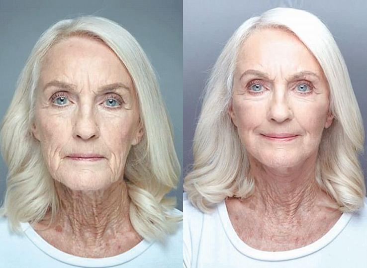 深扒明星美白抗衰秘籍!比防晒管用1000倍!4周逆袭成白皮,悄悄瘦掉8斤