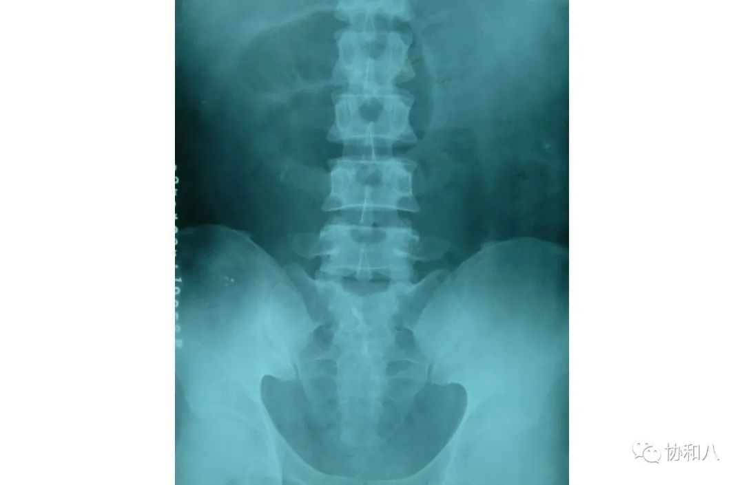 复习这些名解时总觉得怪饿的|协和八·脑洞大开