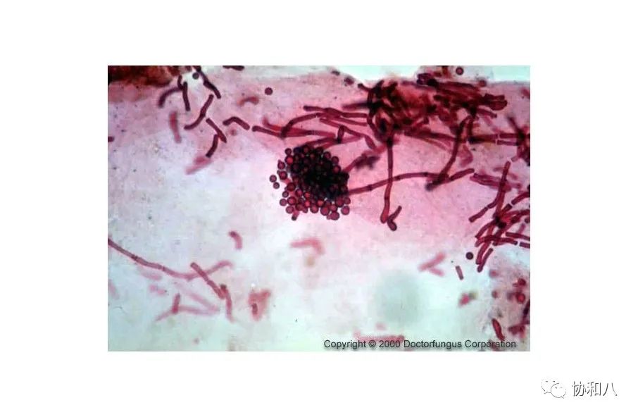 复习这些名解时总觉得怪饿的|协和八·脑洞大开