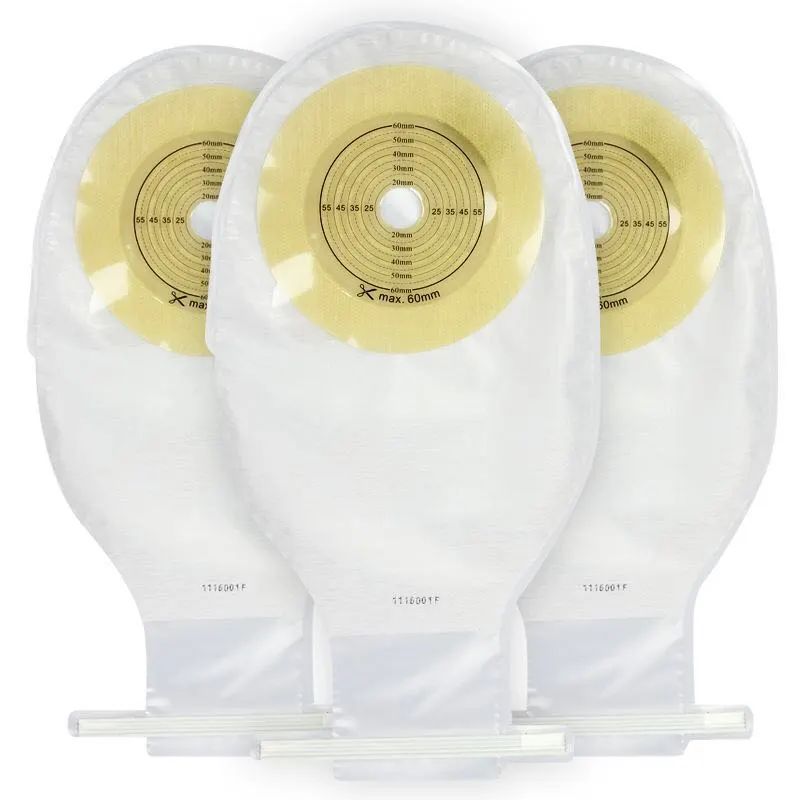 肠造瘘口的护理操作流程,肠造瘘老人饮食护理