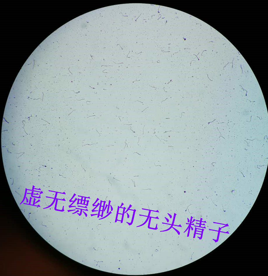 单一畸形精子症,无头精子是头部缺陷精子吗