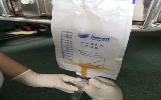 引流器怎么做,引流液怎么测量