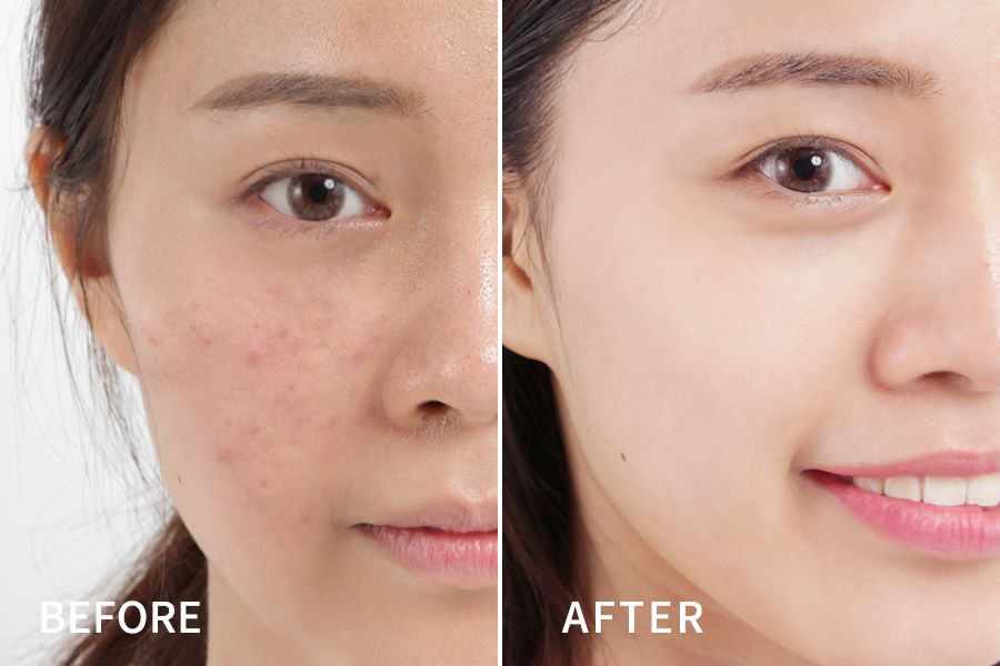 lamer海蓝之谜面霜团购,lamer海蓝之谜2023面霜多少钱