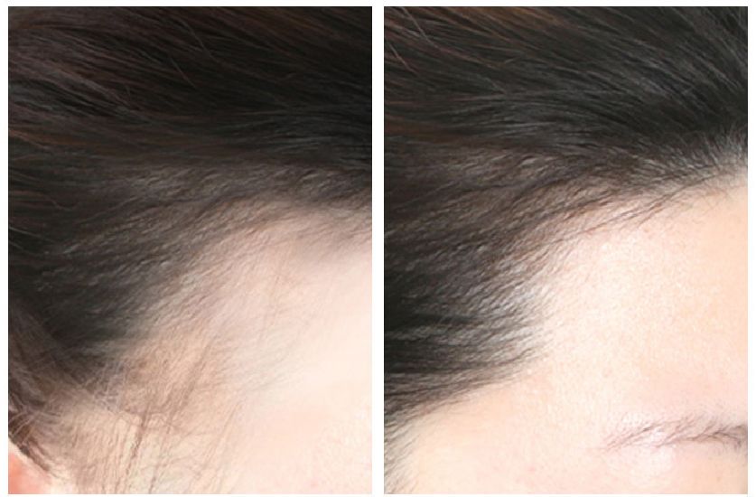 生姜防脱育发洗发水推荐,老姜王生姜防脱育发洗发水300ml